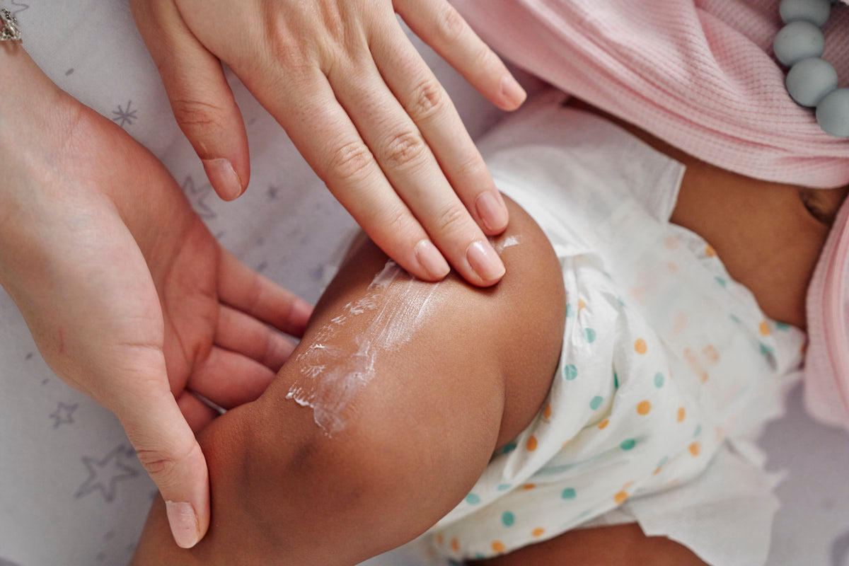 A parent smoothing white cream onto the leg of a baby in a nappy.